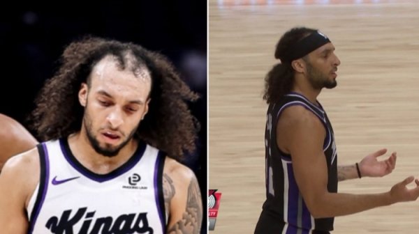 太“秃”然了！互联网的评论让德文-卡特戴上了发带！